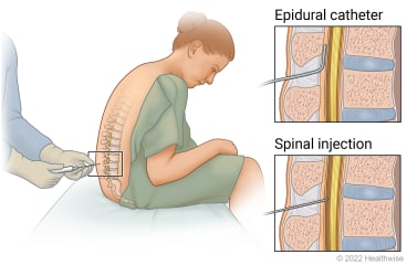 From TENS to Injections: The Full List of Chronic Pain Treatments in Irish Hospitals & Private Clinics